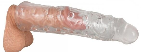 Penis uzatma